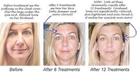 Aesthetics Spa Oakmont PA Microcurrent Ad