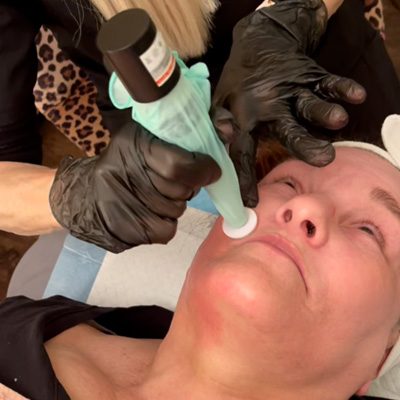 Aesthetics Spa Oakmont PA Microchanneling with Microcurrent